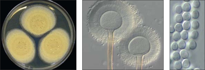  Aspergillus ochraceus, ba tản nấm trên môi trường Czapek yeast autolysate agar (trái), bào tử vô tính mọc đầy trên đầu cành bào tử phân sinh (giữa), bào tử vô tính (phải) - kythuatcanhtac.com